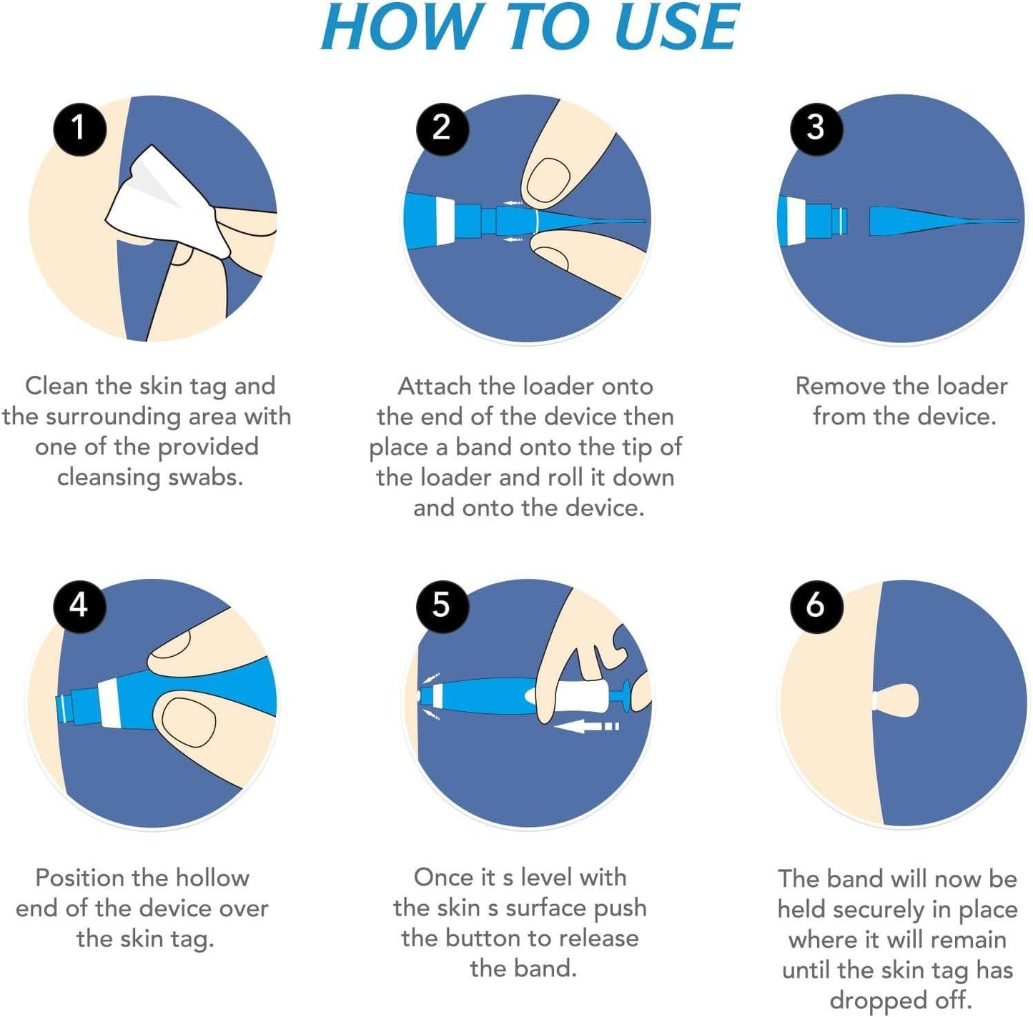Skin Tag Remover Kit - Painless